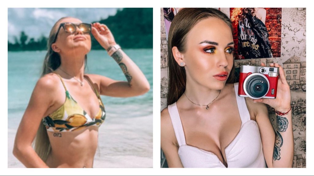Фото — увеличение груди, Милена Безбородова, до и после