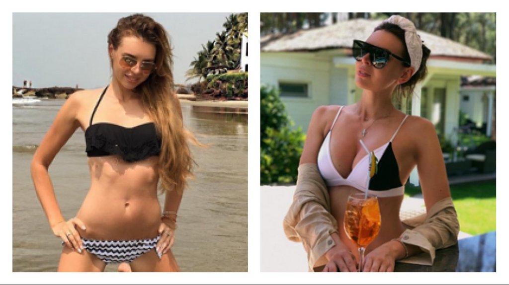 Операция по увеличению груди, Элла Суханова, до и после