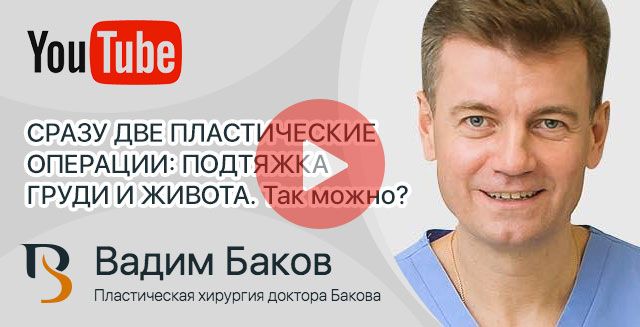 Баков Вадим: подтяжка и увеличение груди с полной абдоминопластикой
